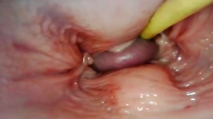 ASTOUNDING INNER POINT OF GLANCE.rage CAMERA INSIDE HER VAGINA WHILE I CRAM HER WITH JIZM